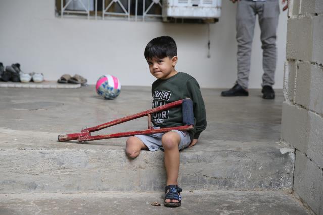 Suriyeli Muhammed hayata tutunacağı protez bacağa kavuştu